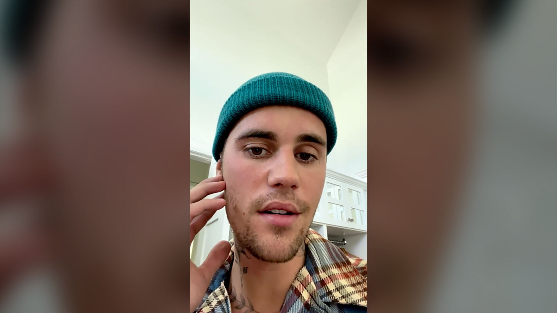 Justin Bieber offers an update on his facial paralysis
